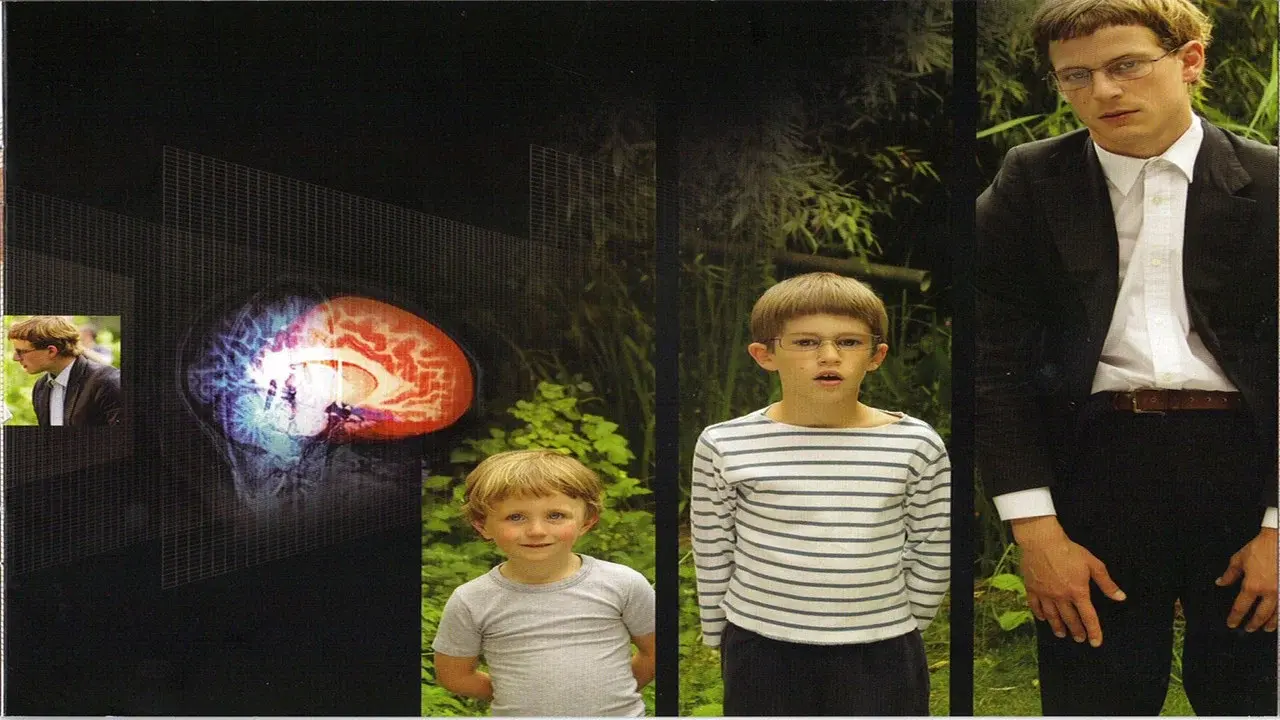 El cerebro de Hugo fondo