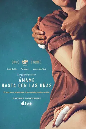 Esto va a doler - Poster