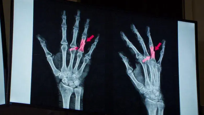 Anatomía de una caída - Fondo